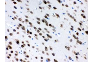 Image no. 1 for anti-ELAV (Embryonic Lethal, Abnormal Vision, Drosophila)-Like 4 (Hu Antigen D) (ELAVL4) (AA 8-45), (N-Term) antibody (ABIN3043372)
