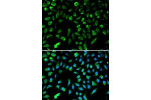 Image no. 5 for anti-Non-Metastatic Cells 1, Protein (NM23A) Expressed in (NME1) (C-Term) antibody (ABIN3020815)