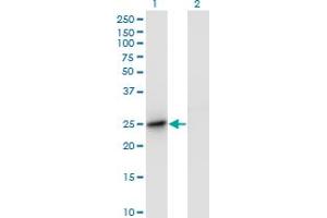 Western Blot analysis of DC-UbP expression in transfected 293T cell line by DC-UbP monoclonal antibody (M01), clone 1B8-1B1.