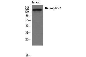 Image no. 1 for anti-Neuropilin 2 (NRP2) (Internal Region) antibody (ABIN3185856)