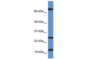 Image no. 1 for anti-TCR gamma Alternate Reading Frame Protein (TARP) (N-Term) antibody (ABIN2788573)