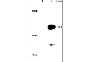 Image no. 3 for anti-rho-Associated, Coiled-Coil Containing Protein Kinase 2 (ROCK2) (AA 1001-1300) antibody (ABIN673359)