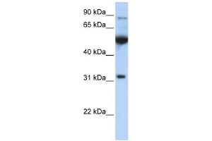 Image no. 1 for anti-Eukaryotic Translation Initiation Factor 2B, Subunit 1 Alpha, 26kDa (EIF2B1) (C-Term) antibody (ABIN632422)