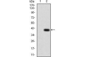 Image no. 3 for anti-Transcription Factor AP-2 alpha (Activating Enhancer Binding Protein 2 Alpha) (TFAP2A) (AA 1-100) antibody (ABIN5542419)