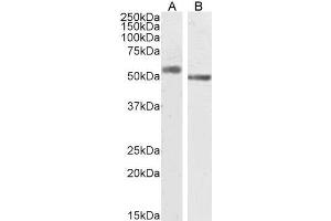 Image no. 1 for anti-Solute Carrier Family 18 (Vesicular Monoamine Transporter), Member 2 (SLC18A2) (C-Term) antibody (ABIN570915)