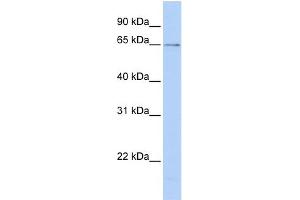 WB Suggested Anti-PPIL2 Antibody Titration: 0.