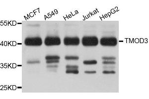 Image no. 1 for anti-Tropomodulin 3 (TMOD3) antibody (ABIN1683055)