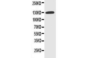 Image no. 4 for anti-Solute Carrier Family 12 (Potassium-Chloride Transporter) Member 2 (SLC12A2) (AA 223-241), (N-Term) antibody (ABIN3043994)
