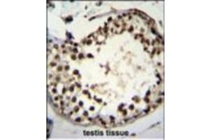 Image no. 3 for anti-Additional Sex Combs Like 1 (ASXL1) (AA 521-549) antibody (ABIN950543)
