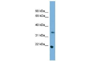 Image no. 1 for anti-Spermatogenesis and Oogenesis Specific Basic Helix-Loop-Helix 1 (SOHLH1) (Middle Region) antibody (ABIN927686)