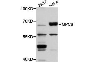 Image no. 1 for anti-Glypican 6 (GPC6) antibody (ABIN1872867)