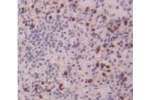 Image no. 2 for anti-Neutrophil Cytosolic Factor 4, 40kDa (NCF4) (AA 132-339) antibody (ABIN1980471)
