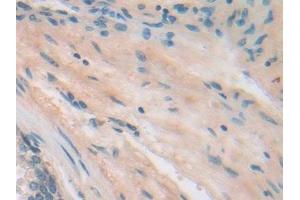 Integrin beta 5 antibody  (AA 137-378)