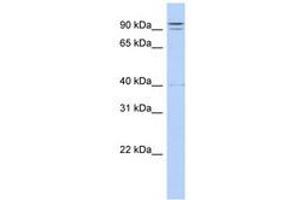 TTC14 antibody  (N-Term)