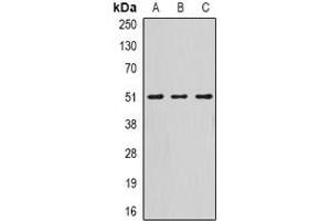 Image no. 1 for anti-serpin Peptidase Inhibitor, Clade A (Alpha-1 Antiproteinase, Antitrypsin), Member 10 (SERPINA10) (full length) antibody (ABIN6006078)