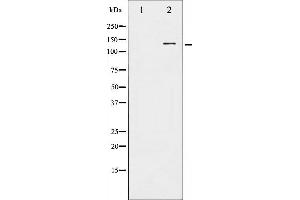 Image no. 1 for anti-Histone Deacetylase 5 (HDAC5) (pSer259) antibody (ABIN6256221)