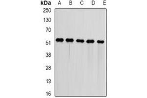 Image no. 2 for anti-DnaJ (Hsp40) Homolog, Subfamily A, Member 3 (DNAJA3) antibody (ABIN2966578)