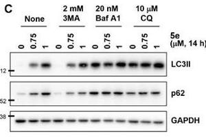 Image no. 116 for anti-Glyceraldehyde-3-Phosphate Dehydrogenase (GAPDH) (Center) antibody (ABIN2857072)