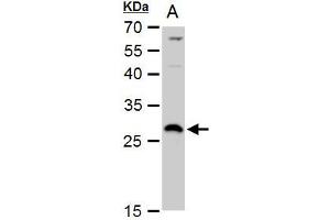Image no. 2 for anti-Deoxycytidine Kinase (DCK) (Center) antibody (ABIN2856517)