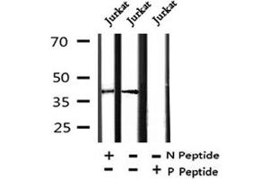 Image no. 2 for anti-Neutrophil Cytosolic Factor 4, 40kDa (NCF4) (pTyr243) antibody (ABIN6270196)