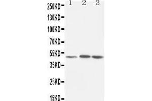 Image no. 1 for anti-Nuclear Receptor Subfamily 1, Group H, Member 3 (NR1H3) (AA 375-398), (C-Term) antibody (ABIN3043617)