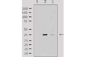 Image no. 2 for anti-Interleukin 20 Receptor beta (IL20RB) (Internal Region) antibody (ABIN6258960)