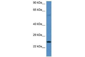 Image no. 1 for anti-RAS-Like, Estrogen-Regulated, Growth Inhibitor (RERG) (Middle Region) antibody (ABIN929305)
