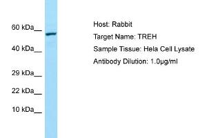 Image no. 1 for anti-Trehalase (Brush-Border Membrane Glycoprotein) (TREH) (Middle Region) antibody (ABIN2790167)