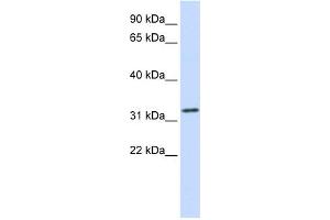 Image no. 1 for anti-Tropomyosin 1 (Alpha) (TPM1) (Middle Region) antibody (ABIN2776817)