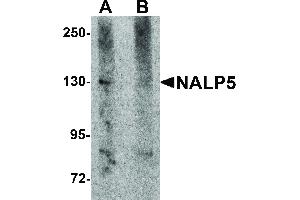 Image no. 1 for anti-NLR Family, Pyrin Domain Containing 5 (NLRP5) (C-Term) antibody (ABIN6656981)