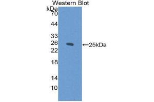 Image no. 1 for anti-Linker For Activation of T Cells (LAT) (AA 33-227) antibody (ABIN1868913)
