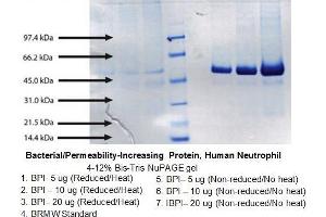 Image no. 1 for Bactericidal/Permeability Increasing Protein (BPI) protein (ABIN1888763)