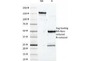 Image no. 3 for anti-SRY (Sex Determining Region Y)-Box 10 (SOX10) (AA 115-269) antibody (ABIN6940624)