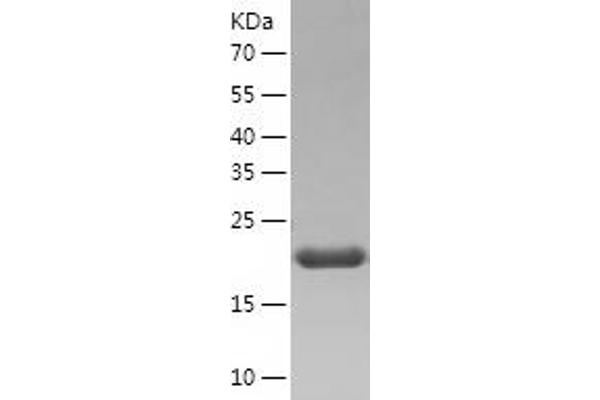 ARL3 Protein (AA 1-182) (His tag)