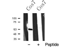 Image no. 1 for anti-Tumor Protein P63 (TP63) antibody (ABIN6263987)