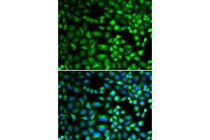 Image no. 4 for anti-Eukaryotic Translation Initiation Factor 5A (EIF5A) antibody (ABIN3015836)
