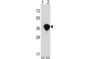 Image no. 3 for anti-Transaldolase 1 (TALDO1) antibody (ABIN3002744)