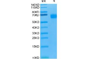 SDS-PAGE (SDS) image for HERV-H LTR-Associating 2 (HHLA2) protein (His tag) (ABIN7273956)
