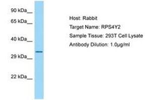 anti-Ribosomal Protein S4, Y-Linked 2 (RPS4Y2) (AA 166-215) antibody