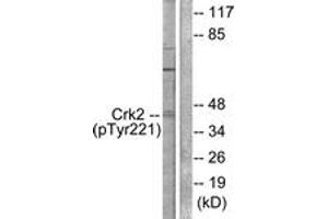 Western blot analysis of extracts from COS7 cells, using CrkII (Phospho-Tyr221) Antibody.