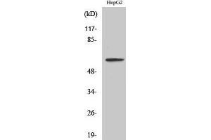Image no. 1 for anti-Interleukin 20 Receptor alpha (IL20RA) (Internal Region) antibody (ABIN3185168)