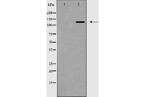 Image no. 3 for anti-Zinc Finger E-Box Binding Homeobox 2 (ZEB2) (N-Term) antibody (ABIN6266097)