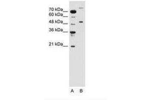 TRIM42 Antikörper  (AA 601-650)