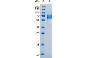 IL-6 Receptor Protein (His tag)