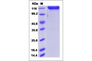 Image no. 1 for Dipeptidyl-Peptidase 4 (DPP4) (AA 29-760) protein (Fc Tag) (ABIN2008231)
