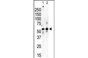 Image no. 1 for anti-Phosphatidylinositol 4-Kinase Type 2 beta (PI4K2B) (AA 305-336), (C-Term) antibody (ABIN5532966)