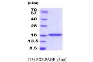 Image no. 1 for Bromodomain Containing 1 (BRD1) (AA 556-688) protein (His tag) (ABIN5853949)