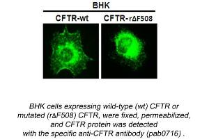 Image no. 1 for anti-Cystic Fibrosis Transmembrane Conductance Regulator (ATP-Binding Cassette Sub-Family C, Member 7) (CFTR) (N-Term) antibody (ABIN559718)