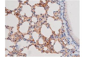 Image no. 3 for anti-Insulin Receptor Substrate 1 (IRS1) (pSer636) antibody (ABIN6255436)