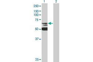 Lamin B Receptor antibody  (AA 1-615)